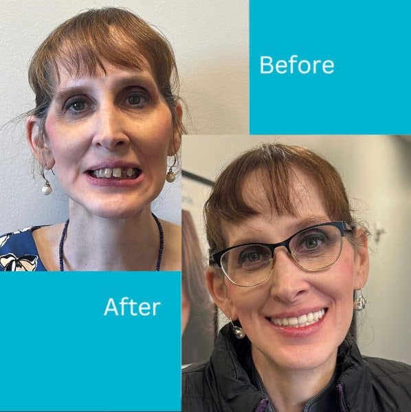 ktrevino-before-after