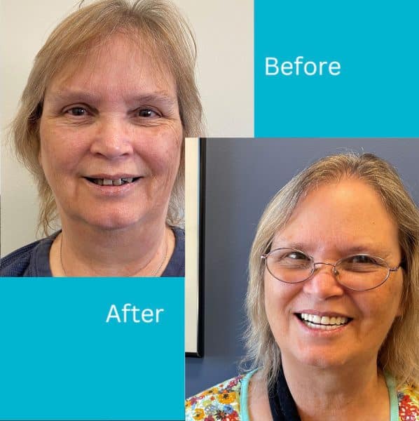 tnelson-before-after