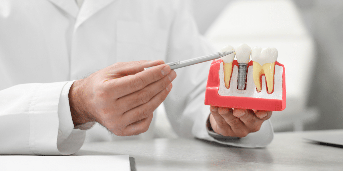 how dental implants work