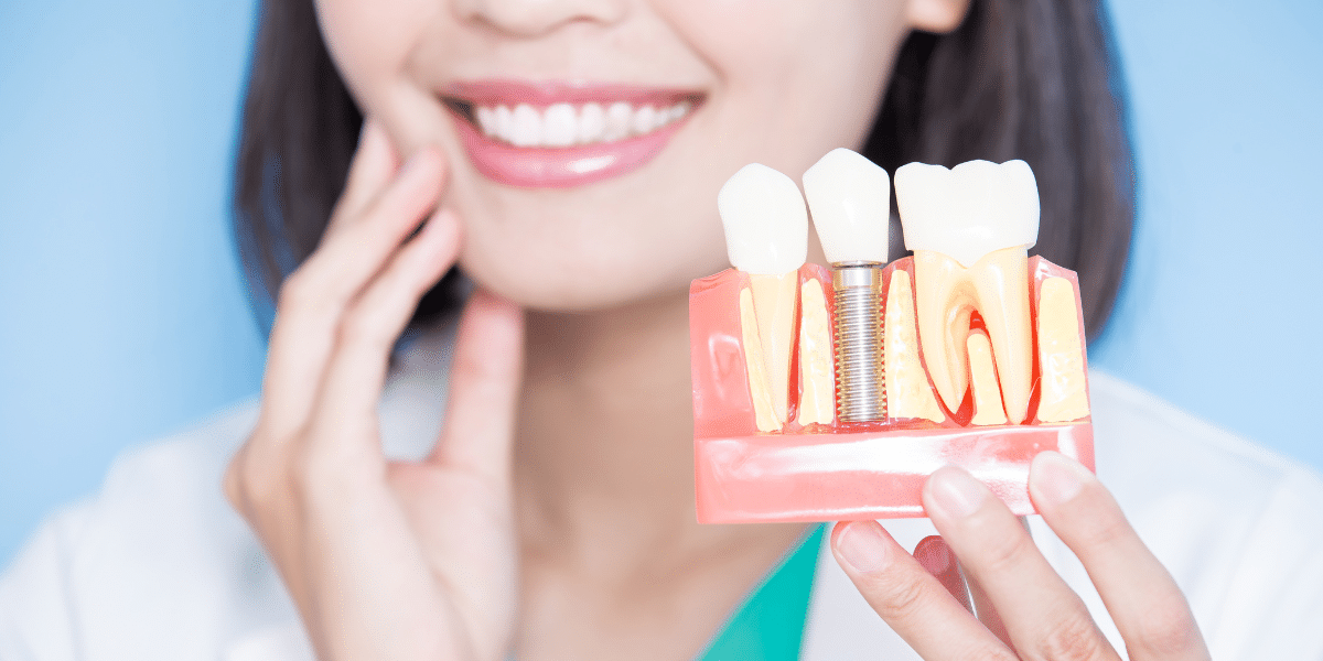 How Long Do Dental Implants Last