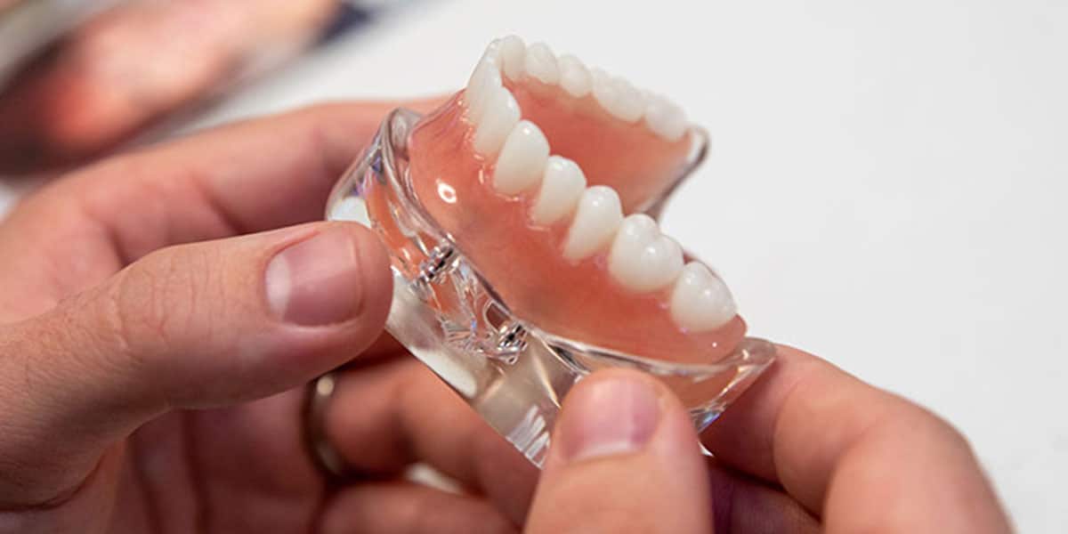 What-are-snap-in-dentures